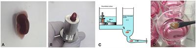 Murine Precision-Cut Kidney Slices as an ex vivo Model to Evaluate the Role of Transforming Growth Factor-β1 Signaling in the Onset of Renal Fibrosis